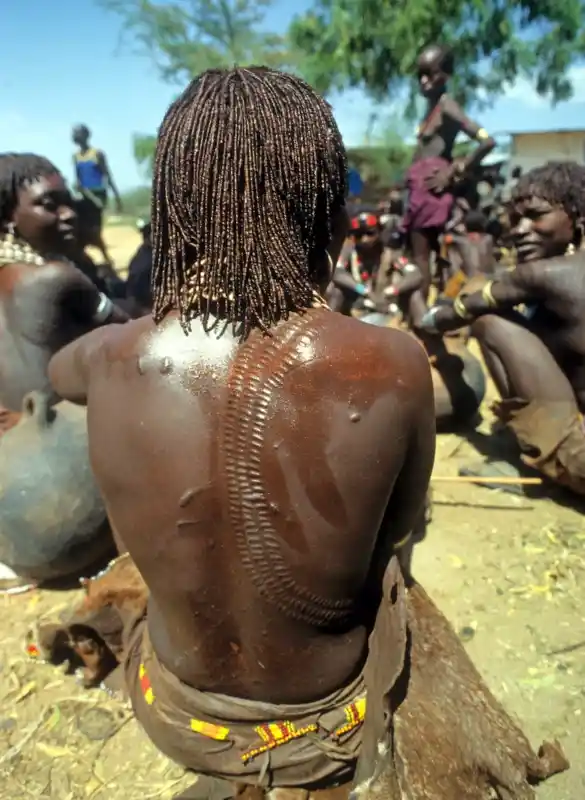 Scarification auf dem Rücken eines Mannes